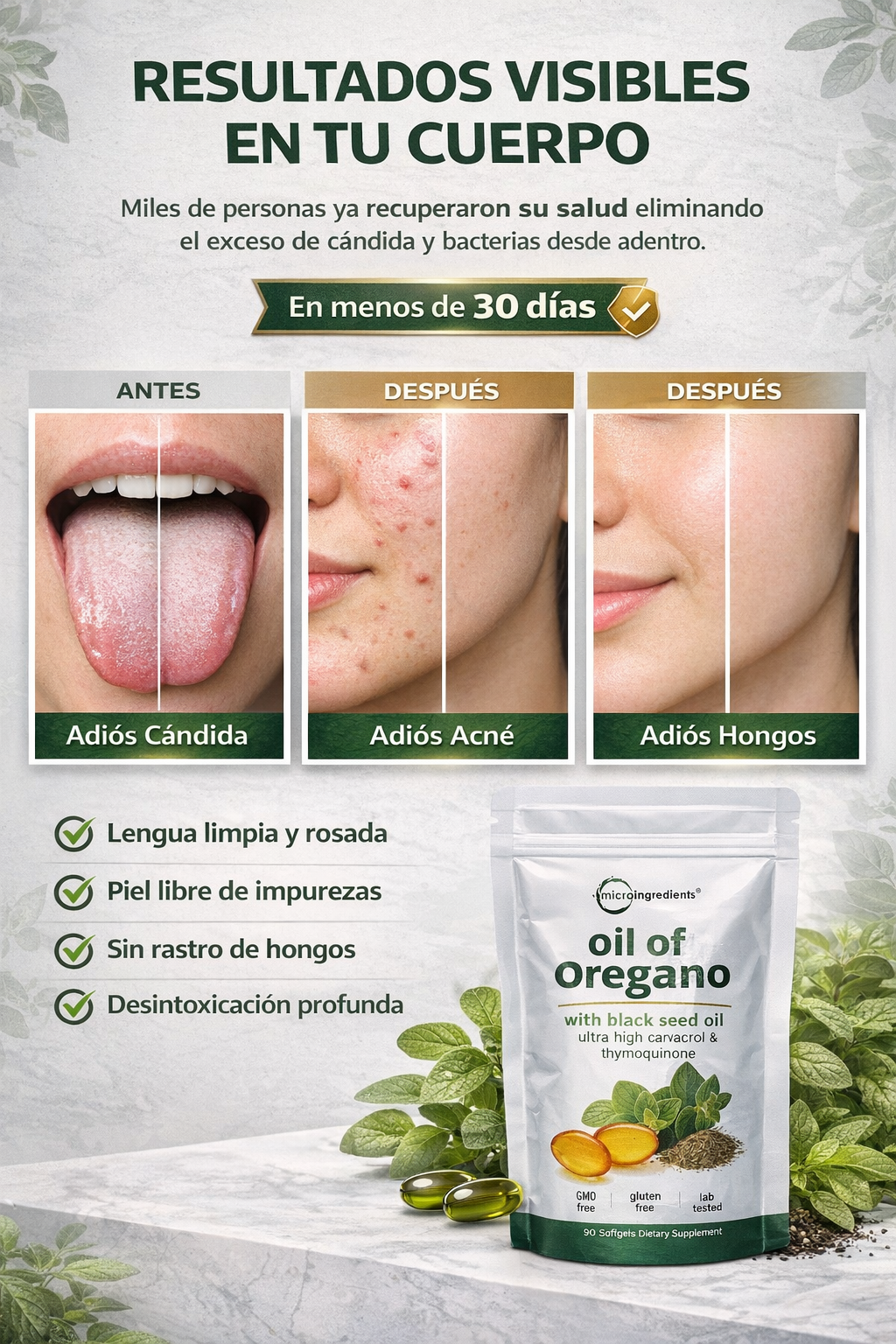 Oregano Oil Antimicrobiano brutal + antiinflamatorio real. Sin parches.