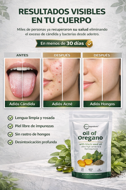 Oregano Oil Antimicrobiano brutal + antiinflamatorio real. Sin parches.